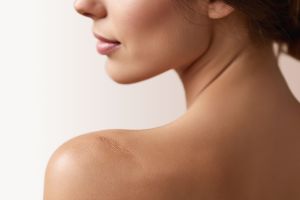 Rētu & Striju ārstešana