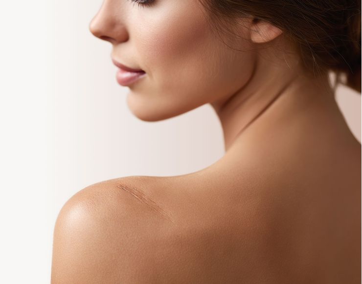 Rētu & Striju ārstešana