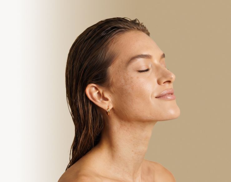 Pigmentation treatment