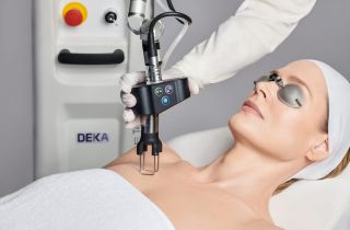 CO₂ лазер Deka Tetra Pro